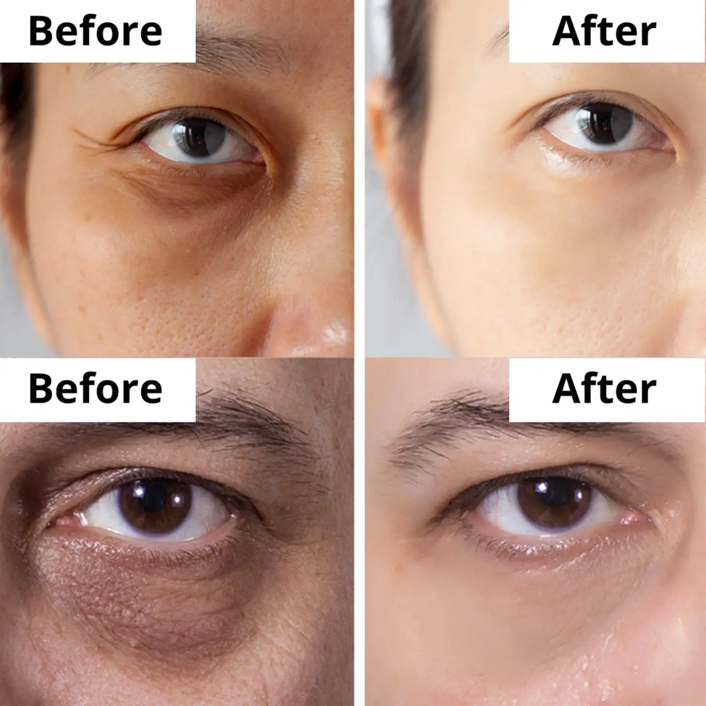 Anua retinol cream - Reduce Wrinkle, fine lines & Hyperpigmentation - Guaranteed Results