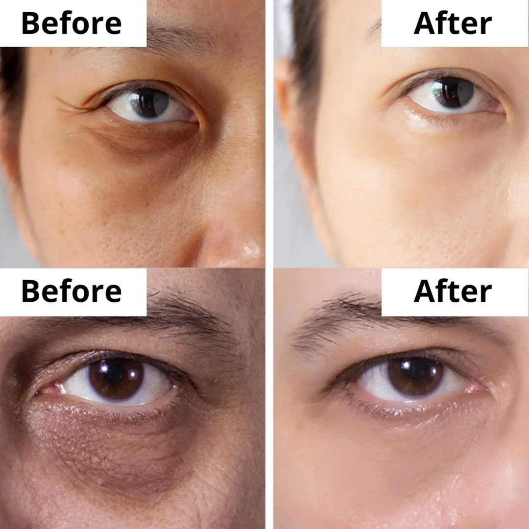 Anua retinol cream - Reduce Wrinkle, fine lines & Hyperpigmentation - Guaranteed Results