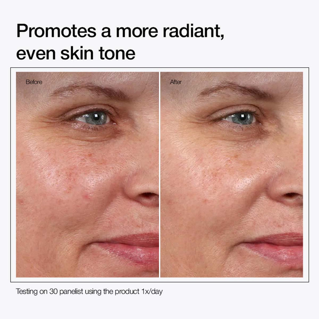 Glycolic Acid 7% Toning Solution(buy 1 get 1 free)