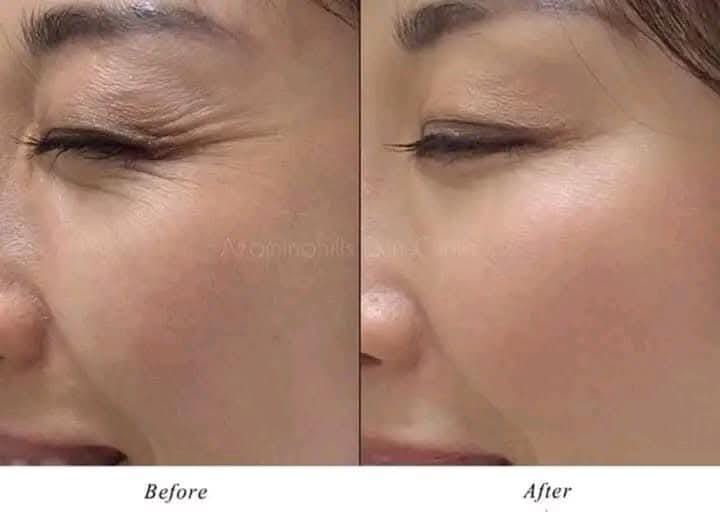 Medicube Deep Vita C Capsule Cream