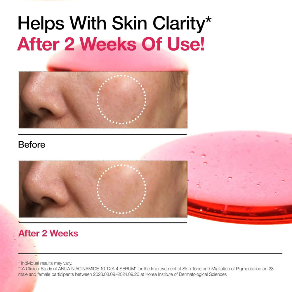 Anua Niacinamide 10 TXA 4 Serum 30ml